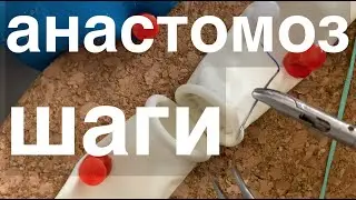 anastomosis in 3 steps / how to train laparoscopic anastomosis / laparoscopic anastomosis tutorial