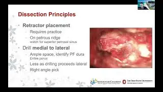 Intracanalicular Vestibular Schwannomas – Professor Daniel Prevedello