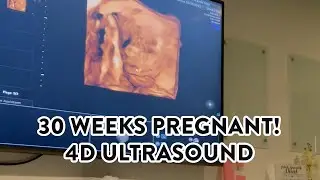 4D ULTRASOUND (30 WEEKS PREGNANT) & WORK THOUGHTS