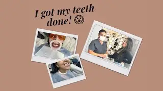 Mini Vlog on my Smile Makeover with Porcelain Veneers!