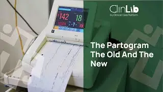The Partogram  The old and the New