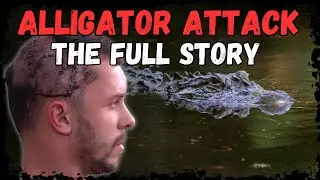 My Alligator Attack Skull Fracture: The FULL Story