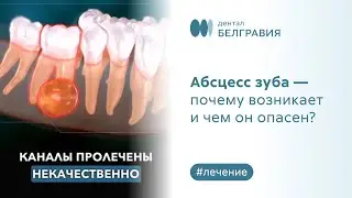 👉 Абсцесс зуба - почему возникает и чем он опасен?
