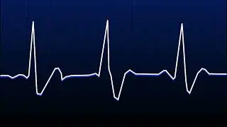 Шум От Биене На Сърце За Приспиване На Бебе/ Бял Шум / Sleep / White Noise / Heart Beating /