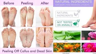Foot Peeling Mask Dead skin Remover