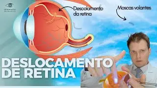Deslocamento de Retina - Explicação mais completa que você precisa ver