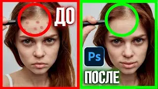 HOW TO REMOVE PIMPLES IN PHOTOSHOP IN 1 MINUTE?