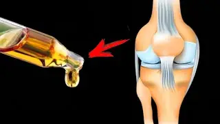 The Best Oil for Instant Joint Pain Relief💥(Very Simple)🤯