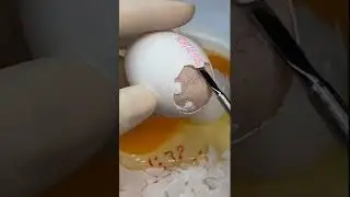 An unlucky day - chicken egg shells