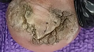 Monster nail