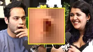 This Couple Tried Having Sex Through Belly Button - 