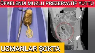 Prezervatife Muz Koyup Yedi Hastanelik Oldu