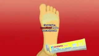 Gehwol Eeltcreme Reclame Poorstretched