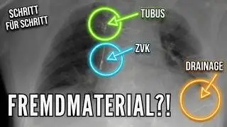 😱 Hilfe! So viel Fremdmaterial im Röntgen Thorax?! Ein erster Beispielfall mit Befundung