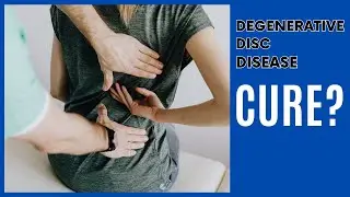 Can you Cure Degenerative Disc Disease?