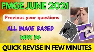 FMGE JUNE 2021 PREVIOUS YEAR image based questions revisions #fmge #neetpg #mbbs #next #fmge2023