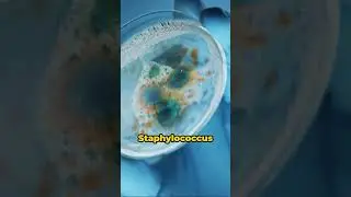 Who Is: Alexander Fleming - The Accident That Saved Millions #medicine #science #scienceeducation