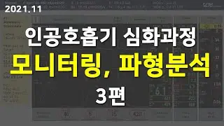 Servo 인공호흡기 심화과정 - 파형분석, 모니터링, 문제해결, 알람처리