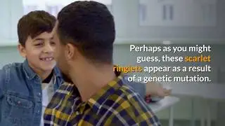 Why Some Men Have Red Beards, Not Hair?