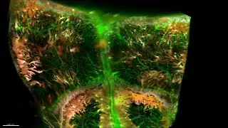 3D MAP OF BLOOD VESSELS AND CELLS IN A MOUSE SKULL
