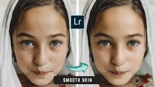 Smooth skin in lightroom | skin smooth editing in lightroom | remove pimple | smooth skin editing 🔥🔥