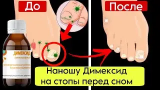 ДИМЕКСИД- это просто ЧУДО! Он мне помог после многих лет страданий с болями в стопах.