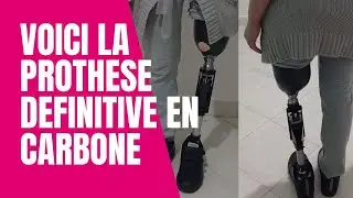 PROTHESE DEFINITIVE FEMORALE EN  CARBONE 2/2.