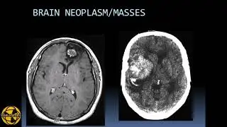 CRANIAL CT SCAN || HEAD / BRAIN CT SCAN ||CLINICAL PROCEDURES AND APPLICATIONS