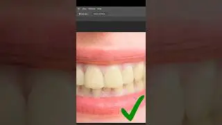 Teeth whitening effect in photoshop🦷