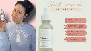 Desafiando el Acné! Probando el Ácido Salicílico de The Ordinary, Pelea Contra los Puntos Negros