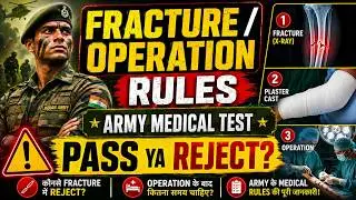 𝐎𝐩𝐞𝐫𝐚𝐭𝐢𝐨𝐧 & 𝐅𝐫𝐚𝐜𝐭𝐮𝐫𝐞 𝐑𝐮𝐥𝐞𝐬 in Indian Army Medical Test | फ्रैक्चर और ऑपरेशन की पूरी जानकारी 𝟐𝟎𝟐𝟏