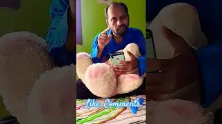 Doctor 😂 ||Manoj Bathrey||🤣