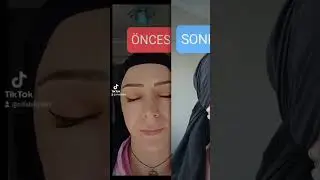 leke kremi setimizden gelen memnuniyet videosu