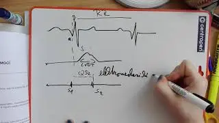 Určování fází srdeční systoly pomocí polygrafického záznamu(praktická)