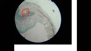 Plant leaf TS midrib