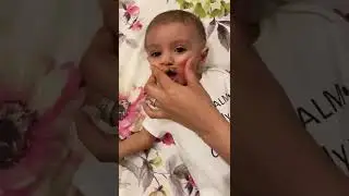 Cute Baby | TK soud.cleftjourney