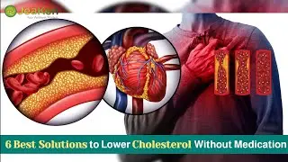6 Best Solutions to Lower Cholesterol Without Medication