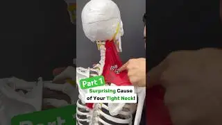 Part 1/2: Is your neck tight with shoulder blade or arm pain? Try this! 