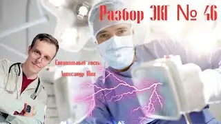 Разбор ЭКГ № 46 (запись стрима в Телеграм)