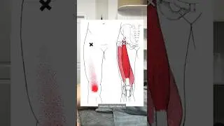 БОЛЬ В КОЛЕНЕ И ПОЯСНИЦЕ