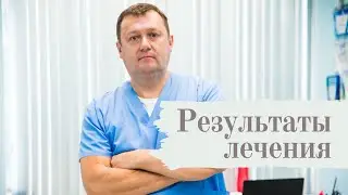 Результаты лечения варикозной болезни у Семенова А.Ю.