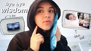 i got my wisdom teeth out...