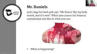 Vascular Emergencies