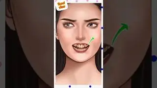 Deep teeth cleaning by doctor👄teeth cleaning asmr#doctorgame#asmr#bcoolamc#yt#short