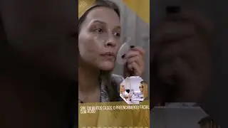 PREENCHIMENTO FACIAL 6