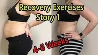 I Do C-Section Recovery Exercises 4-6 Weeks Look What Heppened Fast Recovery (Story #1)