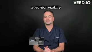 Dr. Grati Sergiu Пластика живота #Абдоменопластика