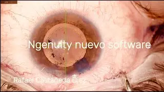 Ngenuity nuevo software