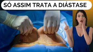 ESTÔMAGO ALTO OU DIÁSTASE COMO TRATAR