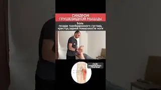 How to treat piriformis syndrome? Sciatic nerve release.